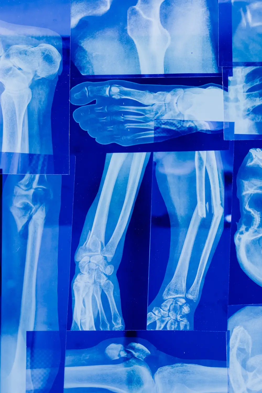 x-rays